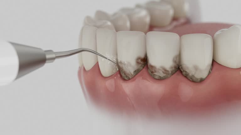 Reliable Dental Implants contractor in Alachua, FL by Smile Center Dentistry